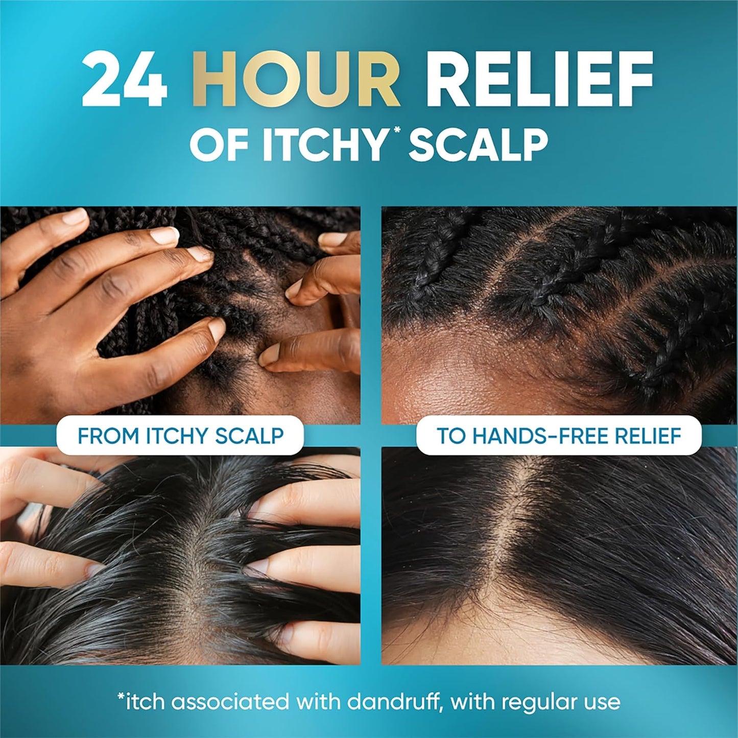 Head & Shoulders Royal Oils Instant Soothe Scalp Elixir Treatment, 4.2oz (125ml) for Dry Scalp